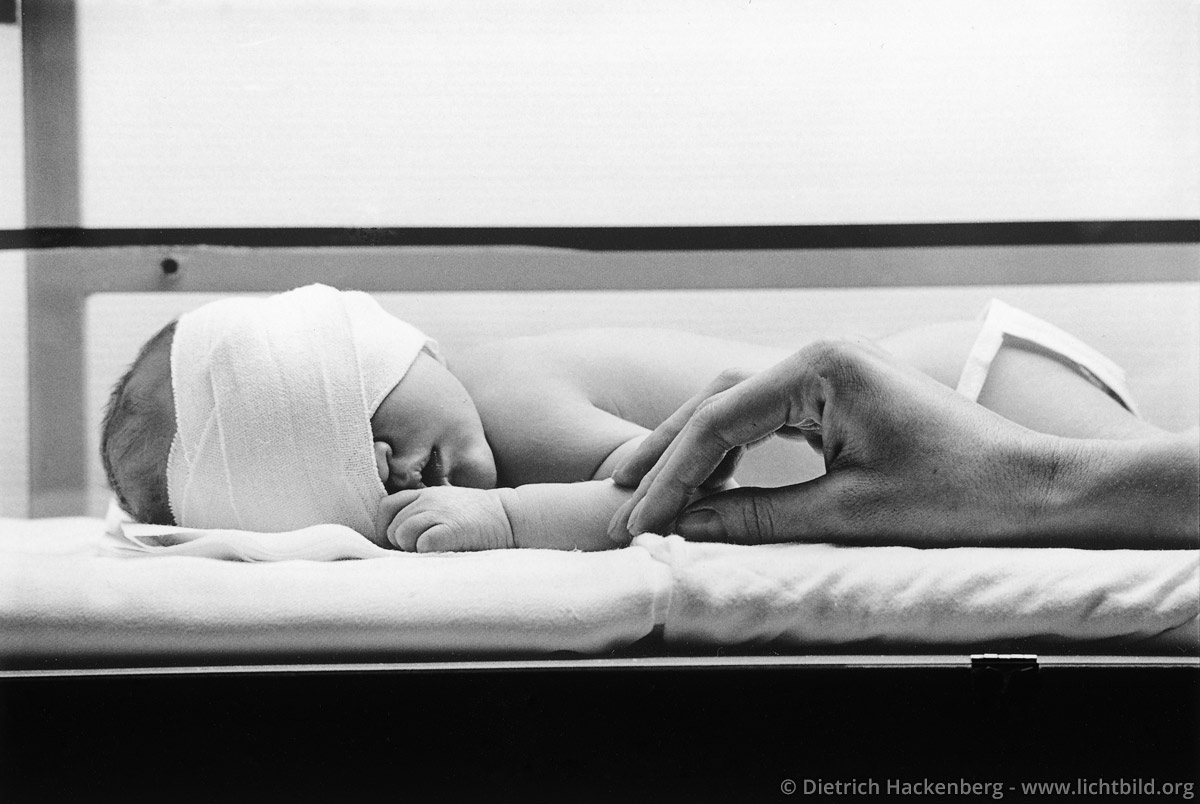 Bestrahlung im Brutkasten - Münster Behandlung eines Säuglings gegen Gelbsucht - Foto © Dietrich Hackenberg