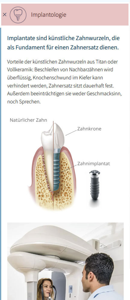 Implantologie aufgeklappt